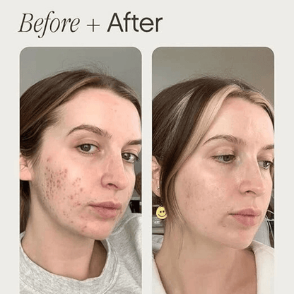 Destàre Skincare™ Topicals FADED Serum (50ml) Brightening Clearing for Dark Spots Uneven Skin Tone